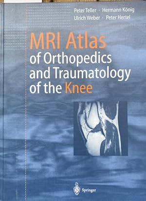 Seller image for MRI Atlas of Orthopedics and Traumatology of the Knee. Foreword by Bernd Hamm. With 324 Figures in 603 separate Illustrations and 17 Tables. for sale by Treptower Buecherkabinett Inh. Schultz Volha