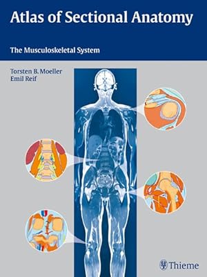 Imagen del vendedor de Atlas of Sectional Anatomy : The Musculoskeletal System a la venta por GreatBookPricesUK