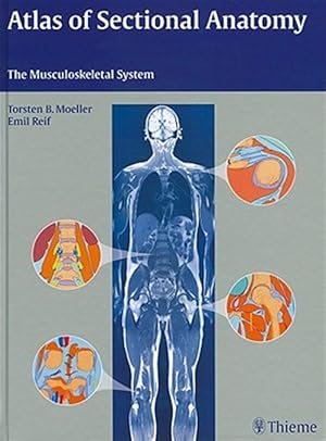 Imagen del vendedor de Atlas of Sectional Anatomy : The Musculoskeletal System a la venta por GreatBookPrices
