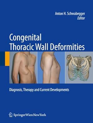 Immagine del venditore per Congenital Thoracic Wall Deformities : Diagnosis, Therapy and Current Developments venduto da AHA-BUCH GmbH