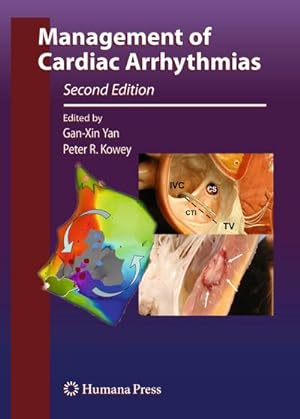 Seller image for Management of Cardiac Arrhythmias for sale by AHA-BUCH GmbH
