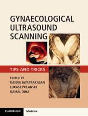 Bild des Verkufers fr Gynaecological Ultrasound Scanning : Tips and Tricks zum Verkauf von AHA-BUCH GmbH