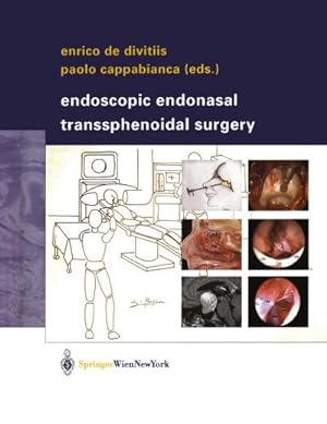 Seller image for Endoscopic Endonasal Transsphenoidal Surgery for sale by BuchWeltWeit Ludwig Meier e.K.