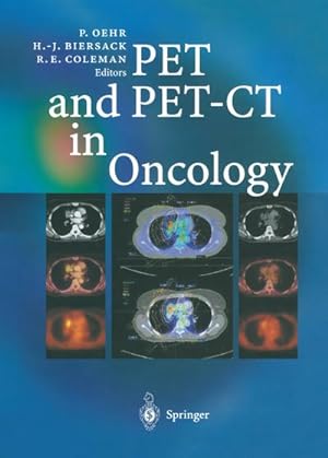 Seller image for PET and PET-CT in Oncology for sale by BuchWeltWeit Ludwig Meier e.K.