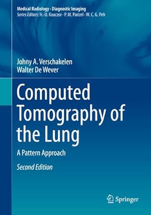 Immagine del venditore per Computed Tomography of the Lung venduto da BuchWeltWeit Ludwig Meier e.K.