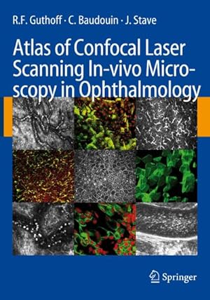 Imagen del vendedor de Atlas of Confocal Laser Scanning In-vivo Microscopy in Ophthalmology a la venta por BuchWeltWeit Ludwig Meier e.K.