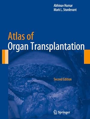 Seller image for Atlas of Organ Transplantation for sale by BuchWeltWeit Ludwig Meier e.K.