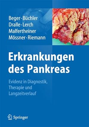 Seller image for Erkrankungen des Pankreas for sale by BuchWeltWeit Ludwig Meier e.K.