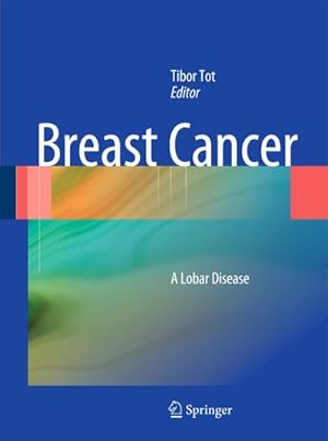 Seller image for Breast Cancer for sale by BuchWeltWeit Ludwig Meier e.K.