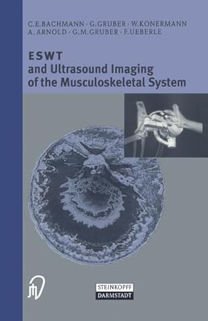 Image du vendeur pour ESWT and Ultrasound Imaging of the Musculoskeletal System mis en vente par BuchWeltWeit Ludwig Meier e.K.