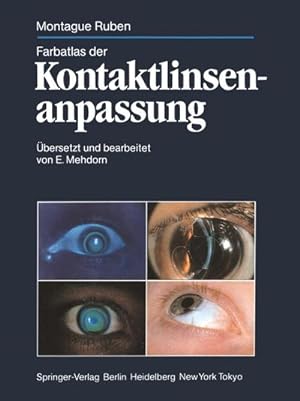 Imagen del vendedor de Farbatlas der Kontaktlinsenanpassung a la venta por BuchWeltWeit Ludwig Meier e.K.