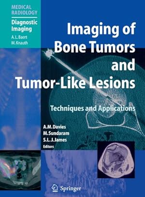 Image du vendeur pour Imaging of Bone Tumors and Tumor-Like Lesions mis en vente par BuchWeltWeit Ludwig Meier e.K.