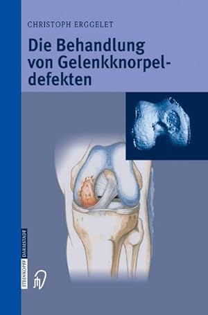 Immagine del venditore per Die Behandlung von Gelenkknorpeldefekten venduto da BuchWeltWeit Ludwig Meier e.K.