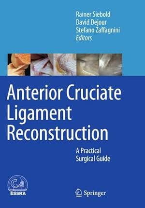 Seller image for Anterior Cruciate Ligament Reconstruction for sale by BuchWeltWeit Ludwig Meier e.K.