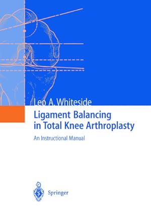 Seller image for Ligament Balancing in Total Knee Arthroplasty for sale by BuchWeltWeit Ludwig Meier e.K.