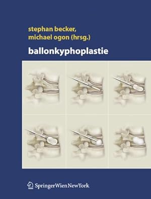 Imagen del vendedor de Ballonkyphoplastie a la venta por BuchWeltWeit Ludwig Meier e.K.