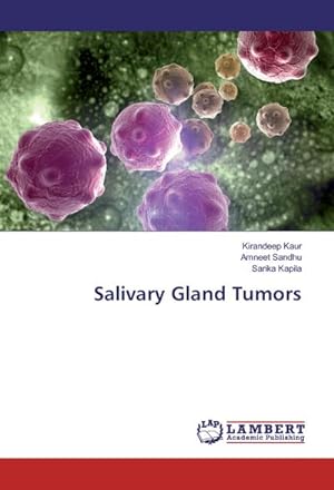 Image du vendeur pour Salivary Gland Tumors mis en vente par BuchWeltWeit Ludwig Meier e.K.