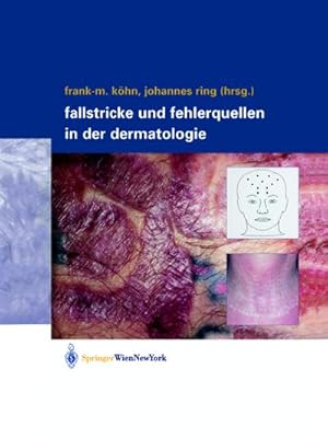 Image du vendeur pour Fallstricke und Fehlerquellen in der Dermatologie mis en vente par BuchWeltWeit Ludwig Meier e.K.