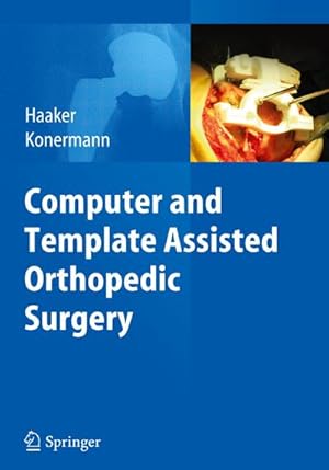 Immagine del venditore per Computer and Template Assisted Orthopedic Surgery venduto da BuchWeltWeit Ludwig Meier e.K.