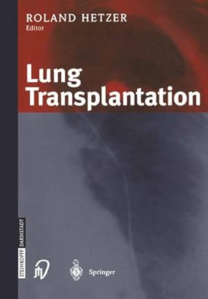 Seller image for Lung Transplantation for sale by BuchWeltWeit Ludwig Meier e.K.