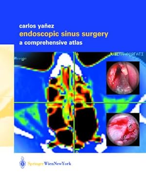 Immagine del venditore per Endoscopic Sinus Surgery venduto da BuchWeltWeit Ludwig Meier e.K.