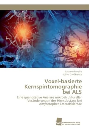 Bild des Verkufers fr Voxel-basierte Kernspintomographie bei ALS zum Verkauf von BuchWeltWeit Ludwig Meier e.K.