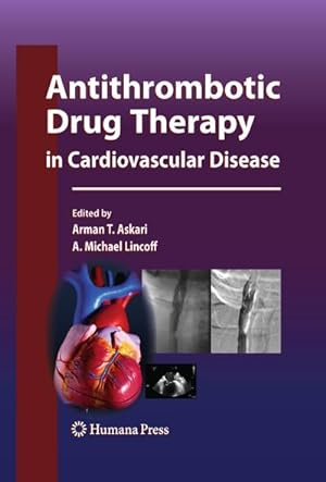 Seller image for Antithrombotic Drug Therapy in Cardiovascular Disease for sale by BuchWeltWeit Ludwig Meier e.K.