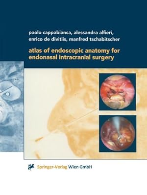 Bild des Verkufers fr Atlas of Endoscopic Anatomy for Endonasal Intracranial Surgery zum Verkauf von BuchWeltWeit Ludwig Meier e.K.