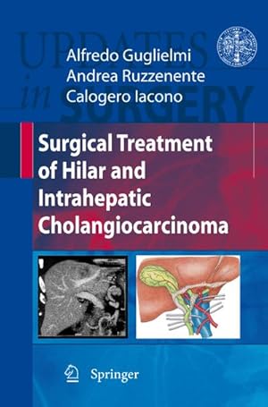 Immagine del venditore per Surgical Treatment of Hilar and Intrahepatic Cholangiocarcinoma venduto da BuchWeltWeit Ludwig Meier e.K.