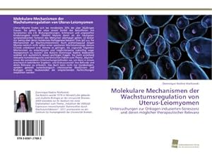 Seller image for Molekulare Mechanismen der Wachstumsregulation von Uterus-Leiomyomen for sale by BuchWeltWeit Ludwig Meier e.K.