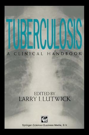 Seller image for Tuberculosis for sale by BuchWeltWeit Ludwig Meier e.K.