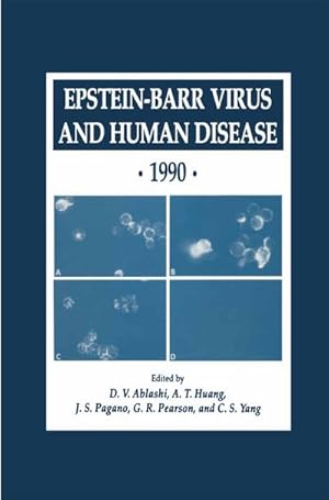 Seller image for Epstein-Barr Virus and Human Disease 1990 for sale by BuchWeltWeit Ludwig Meier e.K.