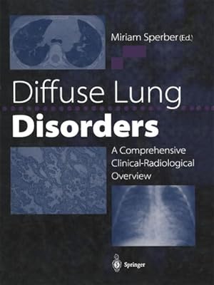 Imagen del vendedor de Diffuse Lung Disorders a la venta por BuchWeltWeit Ludwig Meier e.K.