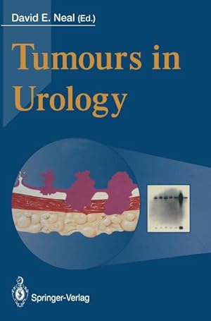 Seller image for Tumours in Urology for sale by BuchWeltWeit Ludwig Meier e.K.