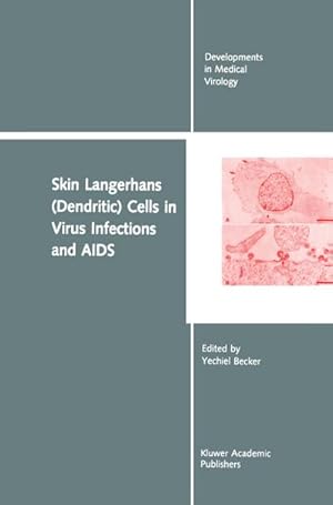 Imagen del vendedor de Skin Langerhans (Dendritic) Cells in Virus Infections and AIDS a la venta por BuchWeltWeit Ludwig Meier e.K.