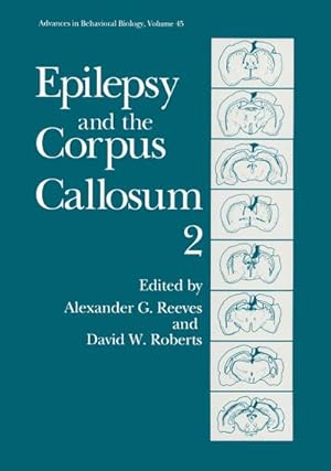 Seller image for Epilepsy and the Corpus Callosum 2 for sale by BuchWeltWeit Ludwig Meier e.K.