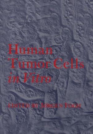 Seller image for Human Tumor Cells in Vitro for sale by BuchWeltWeit Ludwig Meier e.K.