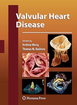 Image du vendeur pour Valvular Heart Disease mis en vente par BuchWeltWeit Ludwig Meier e.K.