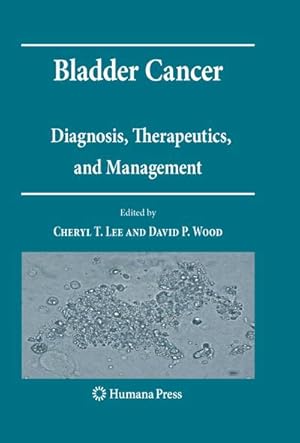 Image du vendeur pour Bladder Cancer mis en vente par BuchWeltWeit Ludwig Meier e.K.