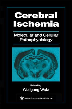 Imagen del vendedor de Cerebral Ischemia a la venta por BuchWeltWeit Ludwig Meier e.K.