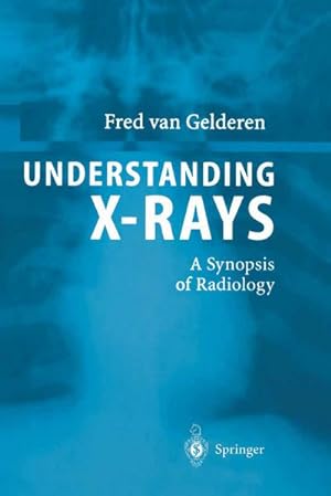Bild des Verkufers fr Understanding X-Rays zum Verkauf von BuchWeltWeit Ludwig Meier e.K.