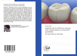 Seller image for Intrts de la CFAO au niveau des restaurations coronaires partielles for sale by BuchWeltWeit Ludwig Meier e.K.
