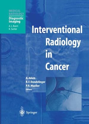 Immagine del venditore per Interventional Radiology in Cancer venduto da BuchWeltWeit Ludwig Meier e.K.