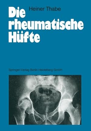 Immagine del venditore per Die rheumatische Hfte venduto da BuchWeltWeit Ludwig Meier e.K.