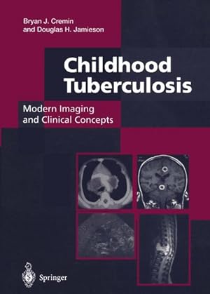 Seller image for Childhood Tuberculosis: Modern Imaging and Clinical Concepts for sale by BuchWeltWeit Ludwig Meier e.K.