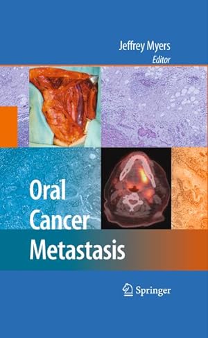 Immagine del venditore per Oral Cancer Metastasis venduto da BuchWeltWeit Ludwig Meier e.K.