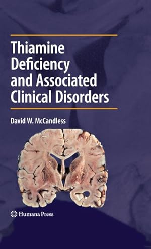 Seller image for Thiamine Deficiency and Associated Clinical Disorders for sale by BuchWeltWeit Ludwig Meier e.K.