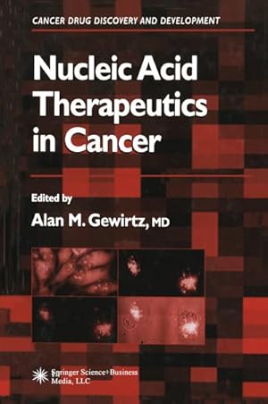 Bild des Verkufers fr Nucleic Acid Therapeutics in Cancer zum Verkauf von BuchWeltWeit Ludwig Meier e.K.