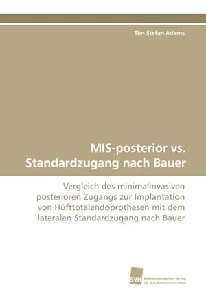 Bild des Verkufers fr MIS-posterior vs. Standardzugang nach Bauer zum Verkauf von BuchWeltWeit Ludwig Meier e.K.