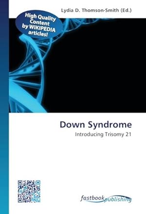 Immagine del venditore per Down Syndrome venduto da BuchWeltWeit Ludwig Meier e.K.